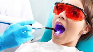 Patient undergoing laser tooth extraction, showcasing advanced techniques for laser cavity removal, laser wisdom tooth extraction, and laser tartar removal, highlighting the benefits of modern dental care.