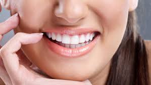 Smile makeover, full smile makeover, cosmetic smile, teeth makeover, and dental makeover in Dubai